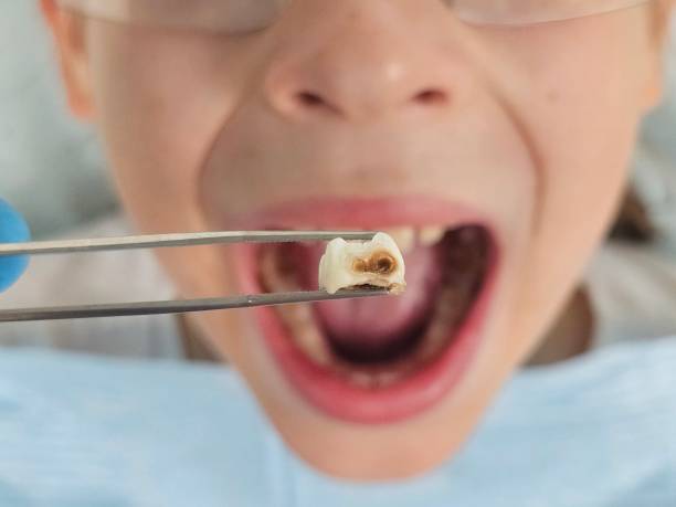 Best Emergency Dental Care for Sports Injuries in Hamlet, NC